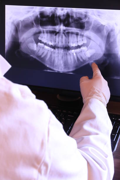 Best Emergency Dental Care for Sports Injuries in Mount Washington, KY
